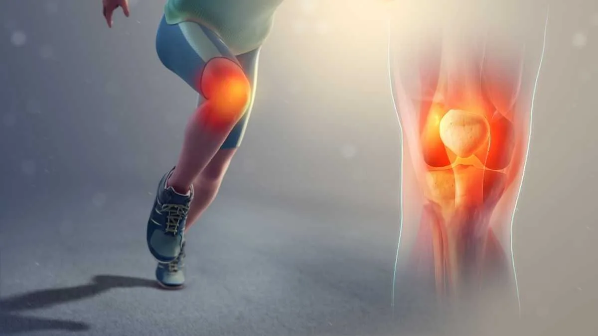 An Illustration of a runner with joint pain