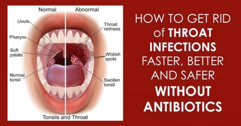 Natural Home Remedies to Reduce Swelling of Throat and Treat A Strep Throat Infection