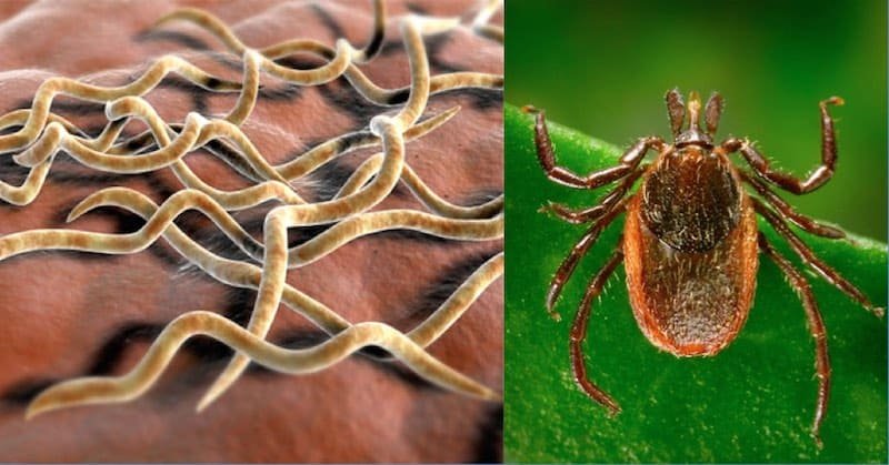 Bacteria, Tick, Lyme Disease