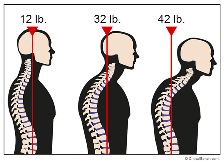 forward head posture fix