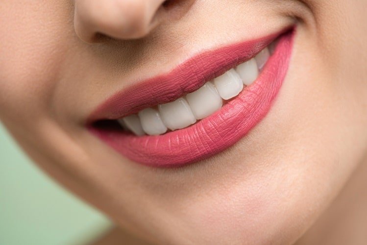 White teeth of a female smile