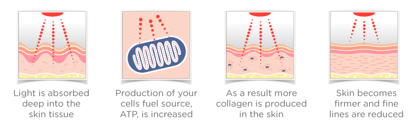 Red Light Therapy for Wrinkles