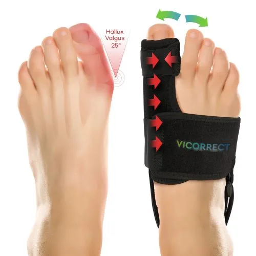 Vicorrect Bunion Corrector for Women and Men