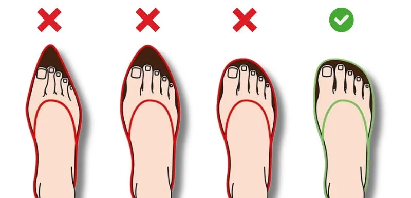 How shoes affect bunions