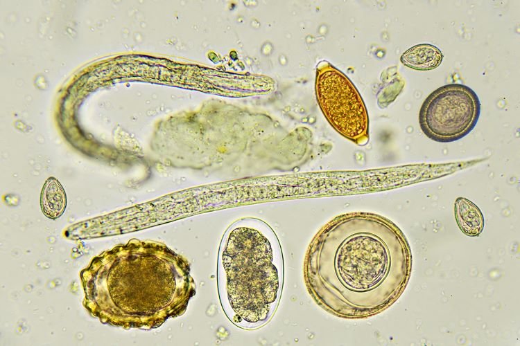 Gut Parasites